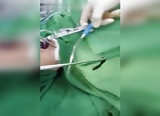 Des médecins sortent une sangsue de la gorge d’un jeune