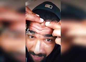 Il se débarrasse d'un énorme bouton au visage