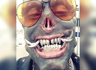 Il subit plusieurs opérations pour ressembler à un démon ! (Ce n'est pas un filtre Snapchat)
